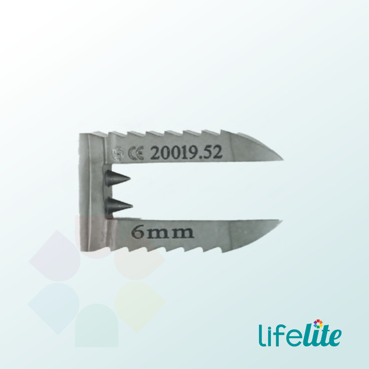 Bone Ligament Staple – Titanium