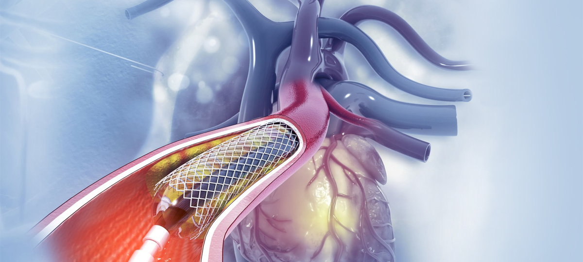 Interventional Cardiology