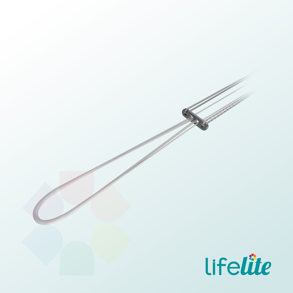 Proloop® Adjustable Loop UHMWPE Suture Titanium Button