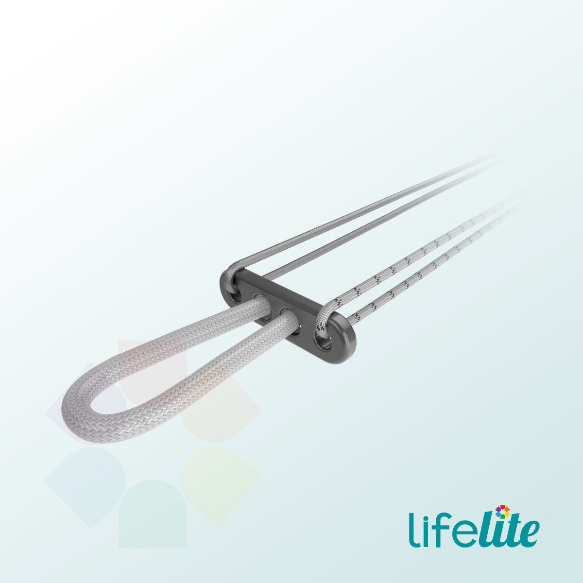 Infiloop® Fixed Loop UHMWPE Suture Titanium Button