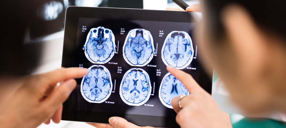 Interventional Neurology