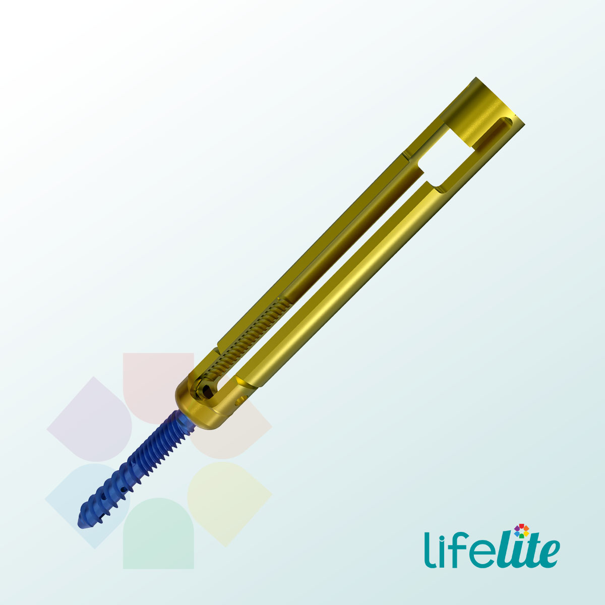 MIS Monolock Osteo Fenestrated Screw