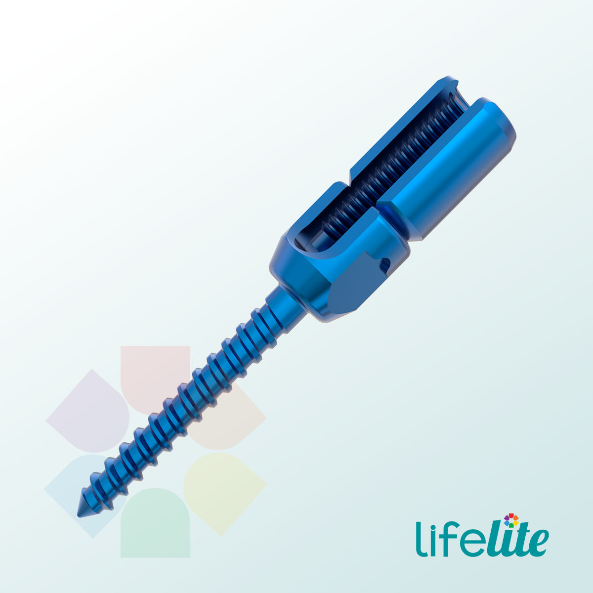 Monolock Polyaxial Reduction Screw Premium SQ