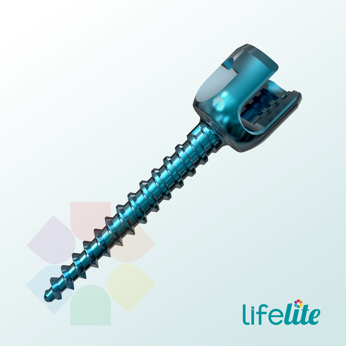 Monolock Ultra Monoaxial Screw