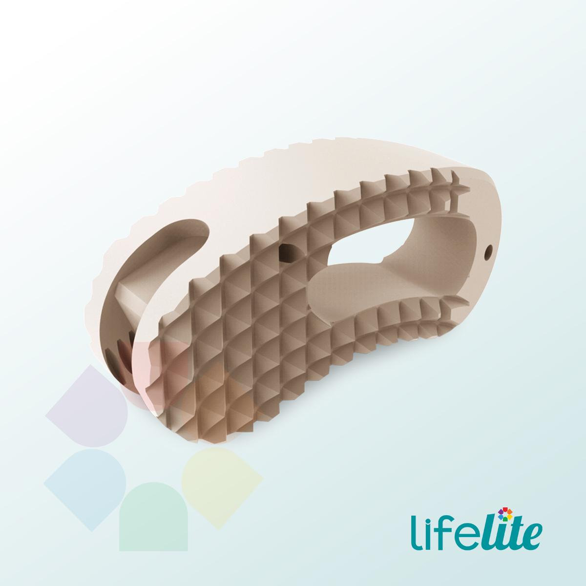 Posfuse TLIF Cage 4 Degree (PEEK)